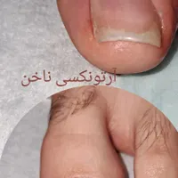 پدولوژ و پدیکوریست تخصصی|خدمات آرایشگری و زیبایی|کرج, گوهردشت|دیوار