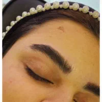 میکروبلیدینگ