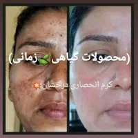 (کرم ضدلک و روشن کننده درخشان)بدون بازگشت|آرایشی، بهداشتی، درمانی|شیراز, قصرالدشت|دیوار