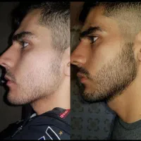 بازگشت اعتماد به نفس تضمینی