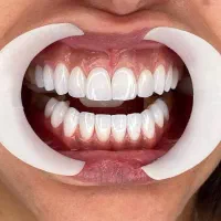 خدمات دندانپزشکی|خدمات زیبایی و سلامت|تهران, خواجه نظام الملک|دیوار