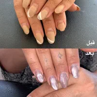 کاشت ناخن فقط ۳۰۰