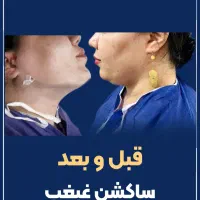 تزریق چربی ،ساکشن غبغب،پی ارپی مو ،مزو زگیل میخچه|خدمات آرایشگری و زیبایی|یاسوج, |دیوار