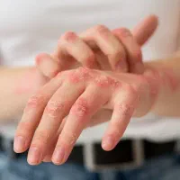 آرامش را به پوست حساس خود بازگردانید