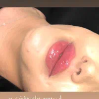 ژل لب ،زاویه سازی،فیلر چانه ،فول فیس|خدمات آرایشگری و زیبایی|مشهد, سجاد شهر|دیوار