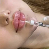 جشنواره تزریق ژل وبوتاکس وفیشال به مدت محدود
