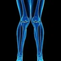 اصلاح ناهنجاری اسکلتی با حرکات