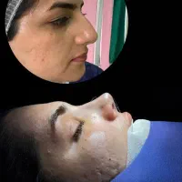 عمل بینی نقد و اقساط ، با هزینه مناسب|خدمات آرایشگری و زیبایی|تهران, میدان ولیعصر|دیوار