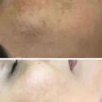 کرم ضد لک لاکچری کوین|آرایشی، بهداشتی، درمانی|تهران, آبشار|دیوار