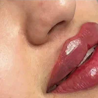 خدمات ژل و بوتاکس بانوان و آقایان