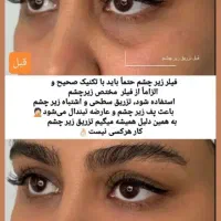 فیلر ژل لب بوتاکس تخصصی پزشک کلینیک تهرانسر|خدمات آرایشگری و زیبایی|اسلام‌شهر, باغ فیض|دیوار