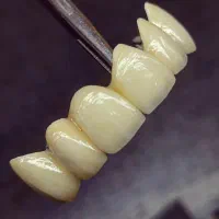 آموزش و کار در لابراتوار دندانسازی