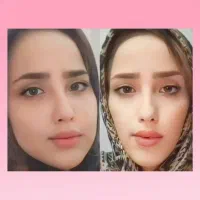 تپلی طبیعی