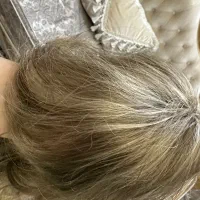 کلاه گیس پوستیژ کاملا نو  وارداتی