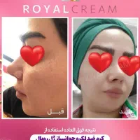 کرم ژل رویال|آرایشی، بهداشتی، درمانی|تهران, افسریه جنوبی|دیوار