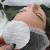 تخفیفات 40% تمام خدمات پوستی|خدمات آرایشگری و زیبایی|بروجرد, |دیوار