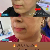 واگذاری کامل کلینیک زیبایی|اجارهٔ دفتر کار، اتاق اداری، مطب|تهران, شهرک ولیعصر جنوبی|دیوار
