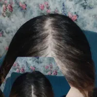 پکیج رویش مجدد مو