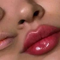 تزریق فیلر و بوتاکس توسط متخصص تخفیف ۵۰ درصدی