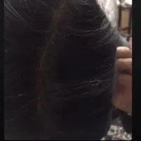 افزایش رشد موی سر و ریش صورت|آرایشی، بهداشتی، درمانی|اصفهان, مصلی|دیوار