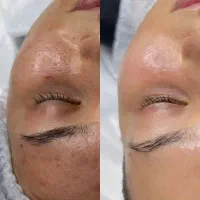 فیشال تخصصی