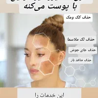 لیزر لک و لیزر کربن تراپی لاغری با کویتیشن و اراف|خدمات آرایشگری و زیبایی|فولادشهر, B4|دیوار