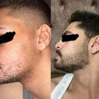 ریش داشته باش تا ریشه دار شوی