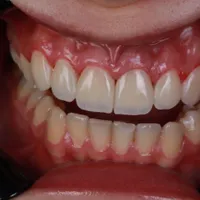دستیار دندانپزشک خانم