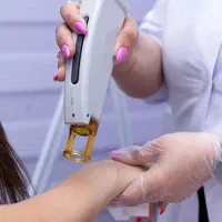 لیزر موهای زائد