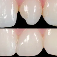 دندانپزشکی بهترین قیمت دانشکده دندانپزشکی گلستان|خدمات آرایشگری و زیبایی|اهواز, گلستان|دیوار