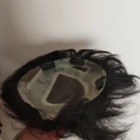 پروتز موی مردانه|آرایشی، بهداشتی، درمانی|تبریز, |دیوار