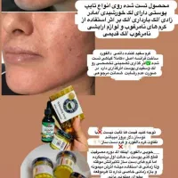 کرم دالفورداصل فرانسه ضدلک قوی بارداری وسفیدی پوست|آرایشی، بهداشتی، درمانی|تهران, اتحاد|دیوار