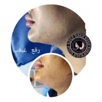 خدمات پوست و زیبایی مجاز|خدمات آرایشگری و زیبایی|شیراز, چوگیاه|دیوار