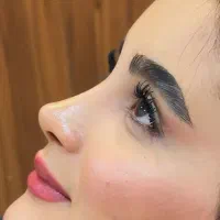 جشنواره جراحی بینی به سبک نوین/فقط ۳۵ملیون (محدود)
