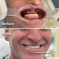 دندانپزشکی لمینت اقساط زیبائی کامپوزیت ارتودنسی|خدمات آرایشگری و زیبایی|مشهد, سجاد شهر|دیوار