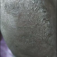 پدیکور و پارافین تراپی و اموزش پدیکور|خدمات زیبایی و سلامت|اهواز, زیتون کارگری|دیوار