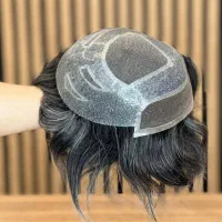 پروتز موی ایران -شهرستان لاهیجان