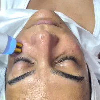 فیشیال و پاکسازی صورت با تخفیف ویژه آخر تابستان|خدمات زیبایی و سلامت|تهران, مینیسیتی (شهرک نفت)|دیوار
