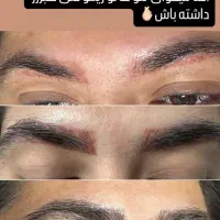 لیزر،بوتاکس، مزوتراپی، فیلر،وایتینگ|خدمات آرایشگری و زیبایی|هشترود, |دیوار