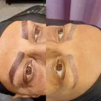 میکروبلیدینگ وشیدینگ