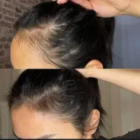 از جمع کچلا دربیا