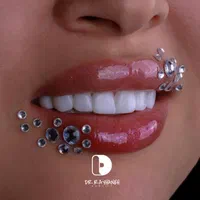 کامپوزیت دندان.لمینت|خدمات آرایشگری و زیبایی|مشهد, کوثر|دیوار