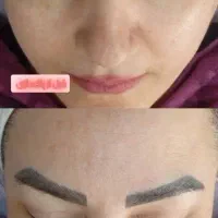 پاکسازی وفشیال صورت