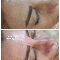 فیشیال تخصصی|خدمات آرایشگری و زیبایی|محمدشهر, محمدشهر|دیوار