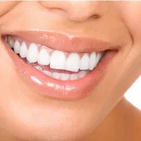 پاسخ به تمامی سوالات دندانپزشکی شما