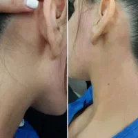 اپیلاسیون و اصلاح ابرو تخصصی با آموزش خصوصی