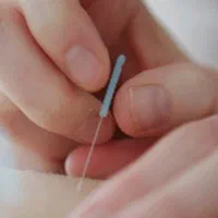 زالودرمانی طب سوزنی و حجامت تخصصی و....