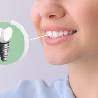 ادمین تولید محتوای کلینیک دندانپزشکی و زیبایی|استخدام رایانه و فناوری اطلاعات|تهران, جنت‌آباد جنوبی|دیوار