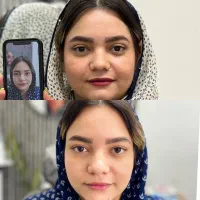 مرکز تخصصی بلفاروپلاستی مشهد ، جراحی پلک مشهد|خدمات آرایشگری و زیبایی|مشهد, احمدآباد|دیوار