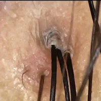 اموزش اسکراب اسکالپ تخصصی با مدرک و خدمات اسکراب|خدمات آرایشگری و زیبایی|تهران, میرداماد|دیوار
